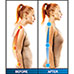 Posture Magic Back Support