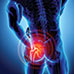 BioHip Hip Support