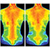 Thera Freeze Cold Therapy Device