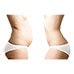Evertone Fat Freezer Body Sculpting System