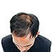 Teleshop Hair Growth Brush with Light Therapy